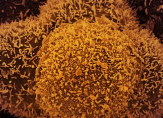 Nova subvariante da covid-19 é identificada em Mato Grosso; primeiro do Brasil