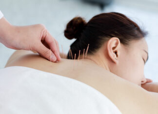 Regulamentado exercício profissional da acupuntura no Brasil