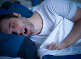 Apneia obstrutiva do sono e aparelho de avanço mandibular