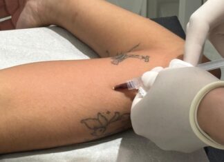 Sinop ultrapassa 1,6 mil aplicações gratuitas do contraceptivo Implanon